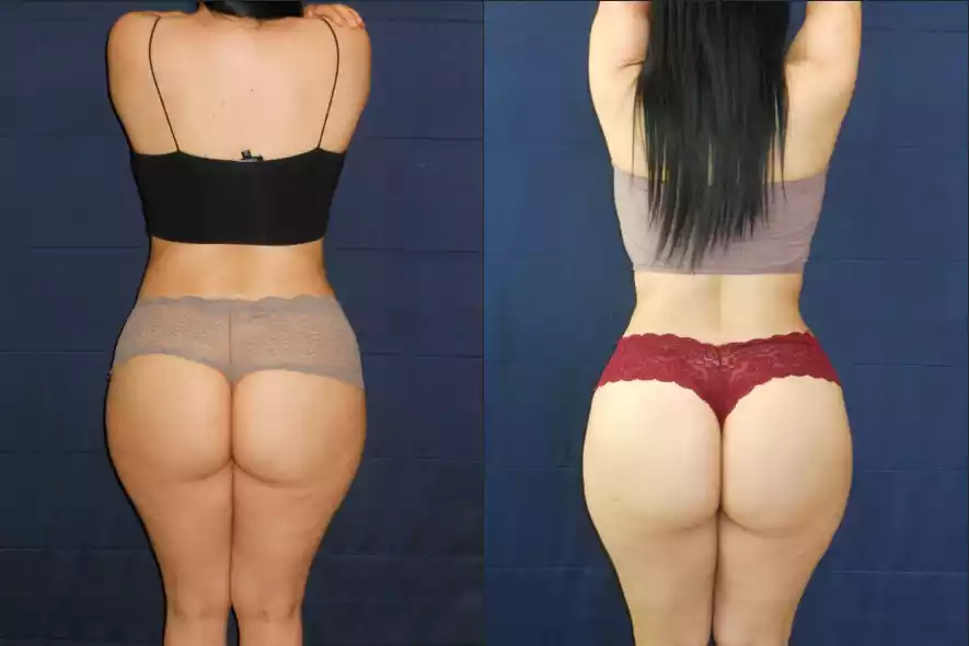 Two side-by-side images showing a woman's back. The left shows her in a grey bra and underwear, and the right shows her in a beige top and red underwear. The photos likely depict a body transformation.