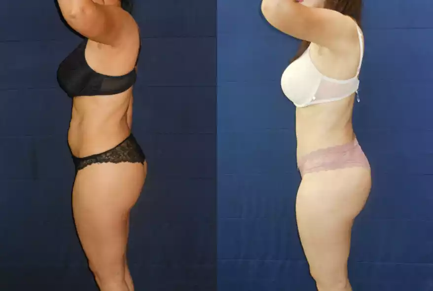 Side-by-side images showing a woman's body before (left) and after (right) apparent physical changes, wearing different colored underwear.