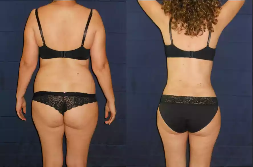 Side-by-side images of a woman from the back before and after a body transformation, showcasing changes in body shape and posture.