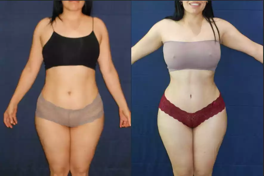 Before and after photos of a woman showing body transformation. The woman is wearing a black top and gray underwear on the left, and a strapless top and red underwear on the right.