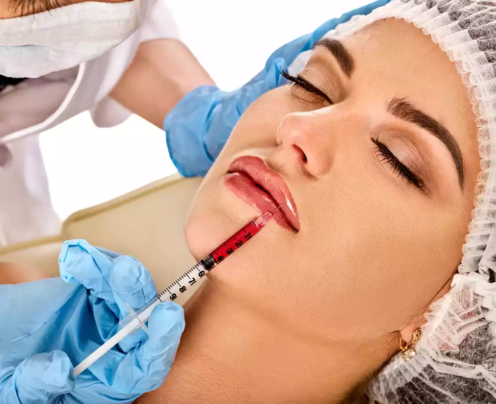 lip fillers